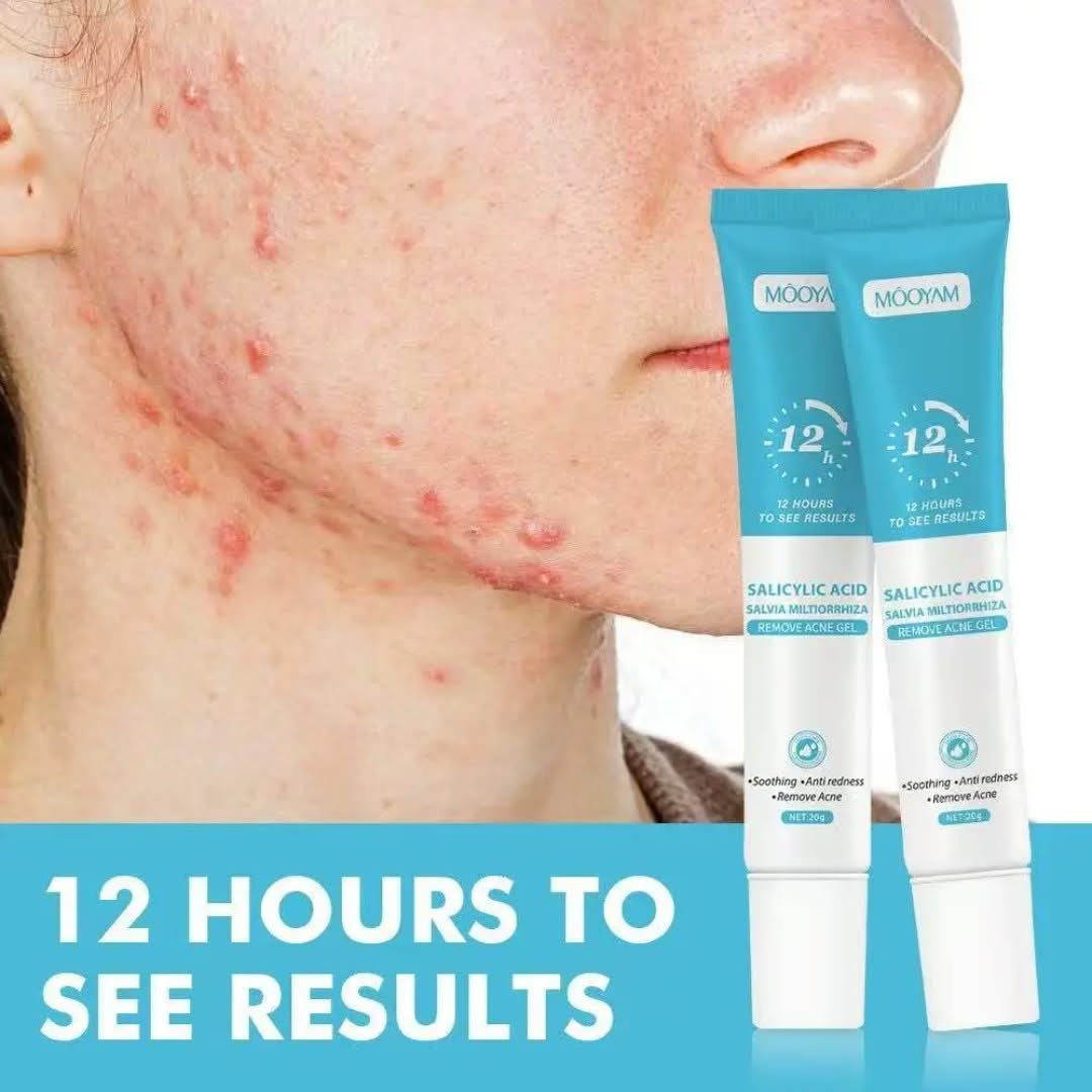 MOOYAM Gel Anti-